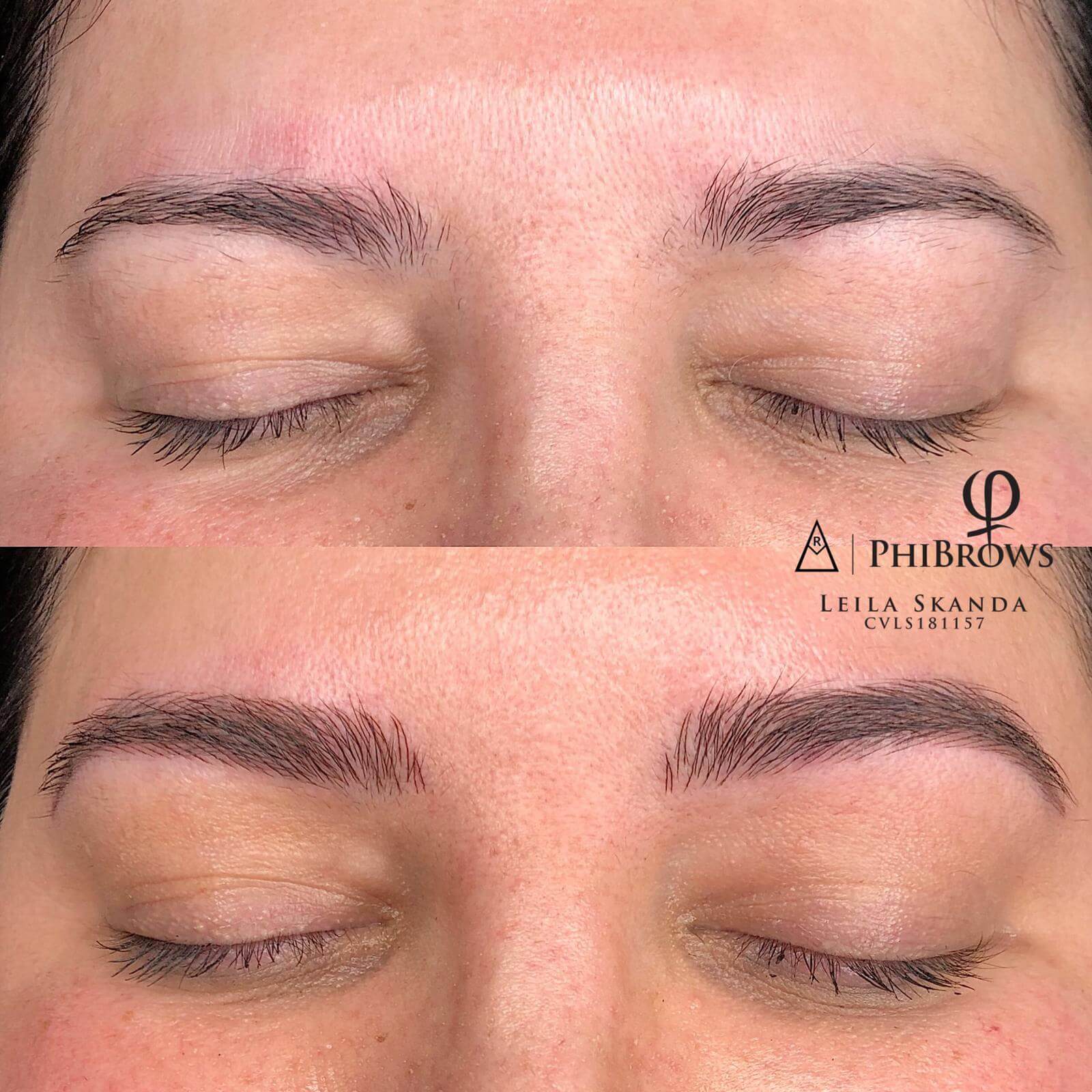 Eyebrow Mapping & Symmetry Fixing Uneven Brows XoBrows